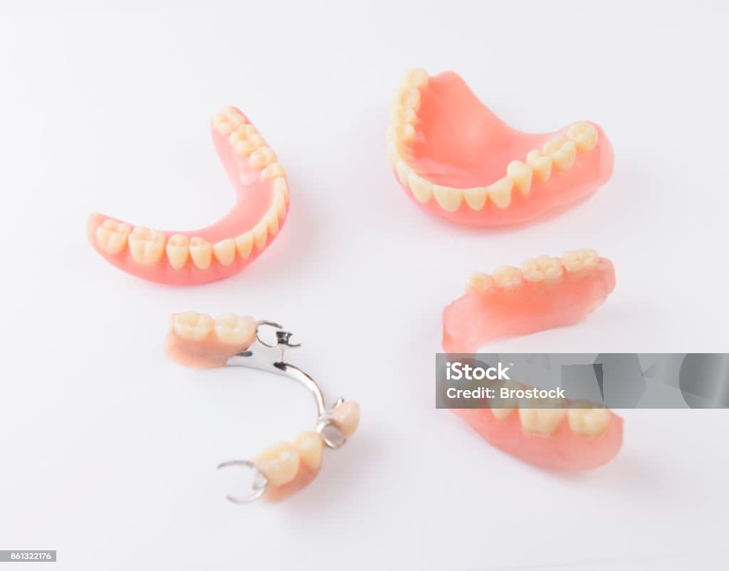 Partial Metal Frame denture service