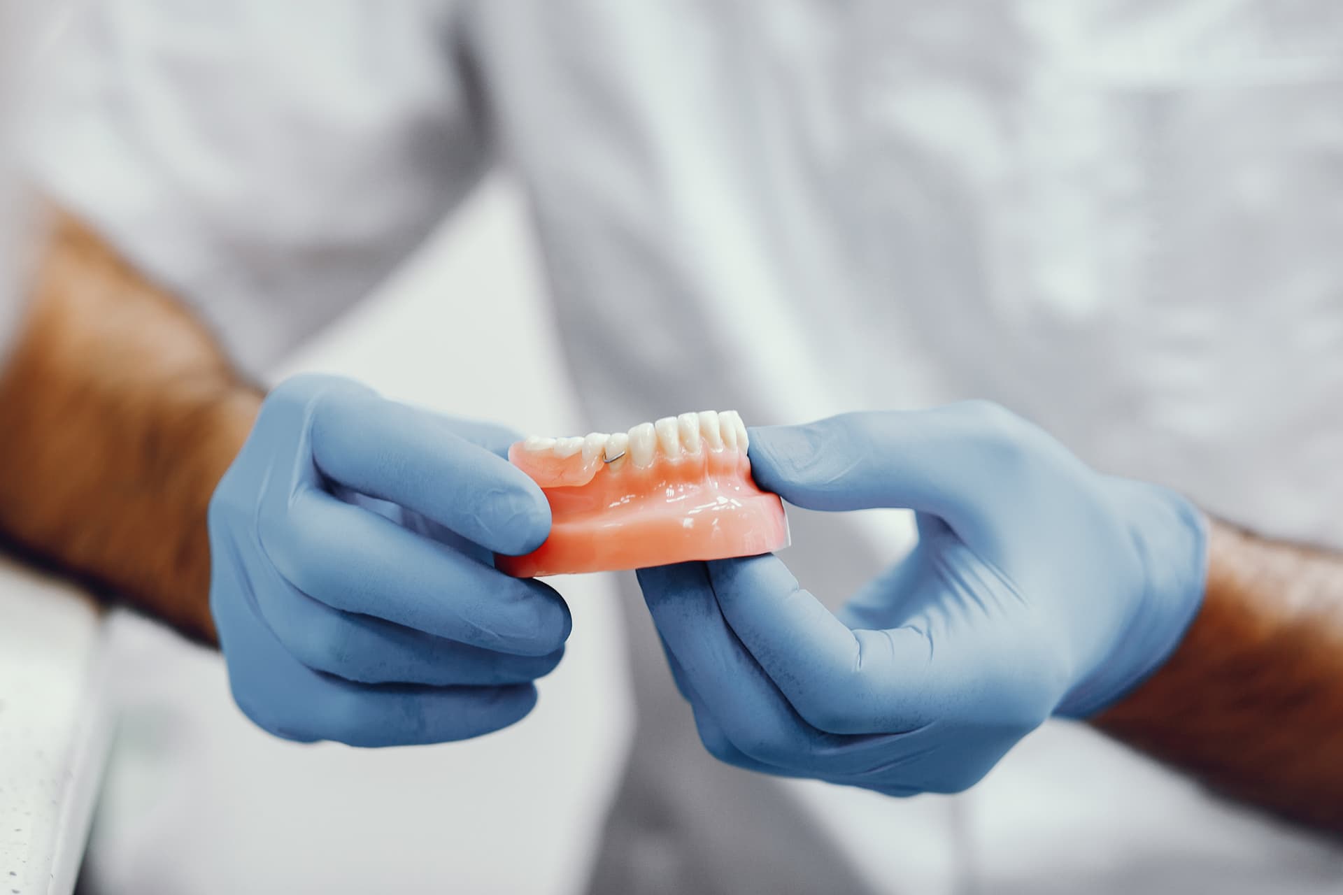 Partial Acrylic denture service